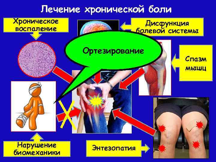 Лечение хронической боли Хроническое воспаление Дисфункция болевой системы Ортезирование Нарушение биомеханики Энтезопатия Спазм мышц