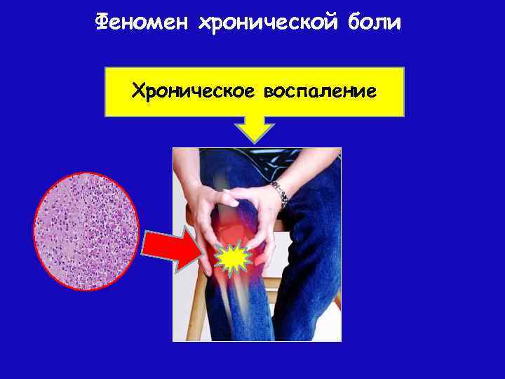 Феномен хронической боли Хроническое воспаление 