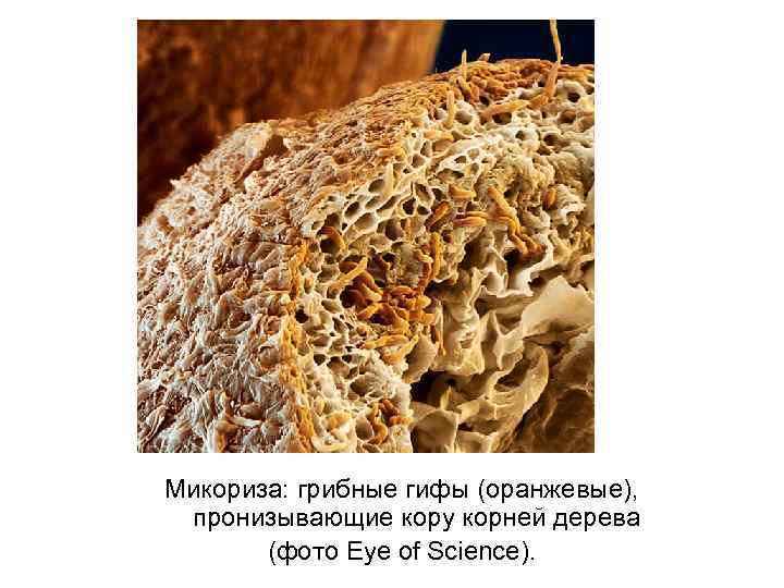Микориза: грибные гифы (оранжевые), пронизывающие кору корней дерева (фото Eye of Science). 