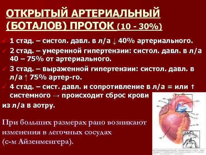 ОТКРЫТЫЙ АРТЕРИАЛЬНЫЙ (БОТАЛОВ) ПРОТОК (10 30%) 1 стад. – систол. давл. в л/а ↓