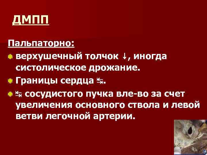 ДМПП Пальпаторно: верхушечный толчок ↓, иногда систолическое дрожание. Границы сердца ↹. ↹ сосудистого пучка