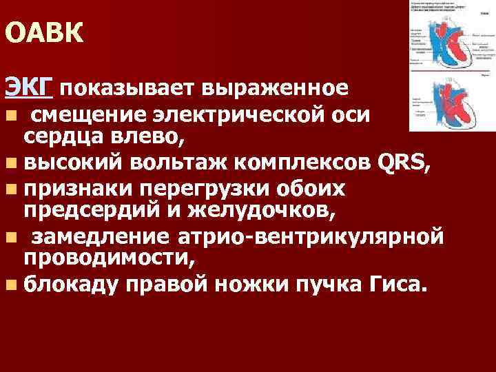 ОАВК ЭКГ показывает выраженное смещение электрической оси сердца влево, n высокий вольтаж комплексов QRS,