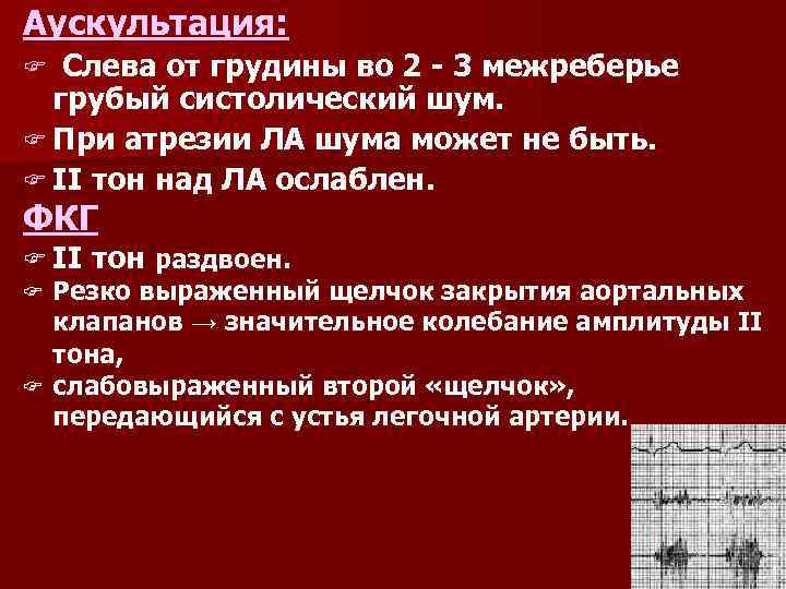 Аускультация: Слева от грудины во 2 3 межреберье грубый систолический шум. F При атрезии