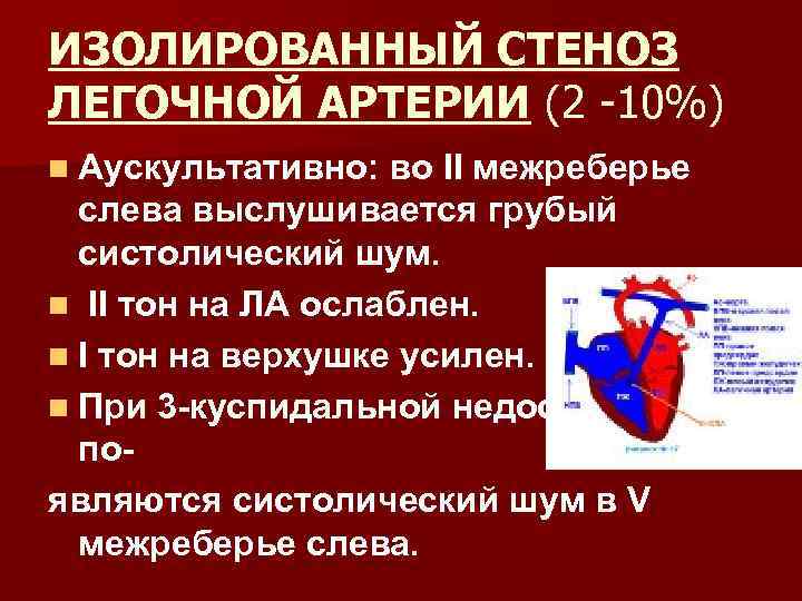 ИЗОЛИРОВАННЫЙ СТЕНОЗ ЛЕГОЧНОЙ АРТЕРИИ (2 -10%) n Аускультативно: во II межреберье слева выслушивается грубый