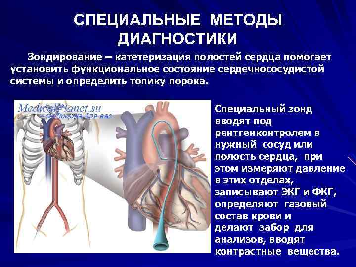 СПЕЦИАЛЬНЫЕ МЕТОДЫ ДИАГНОСТИКИ Зондирование – катетеризация полостей сердца помогает установить функциональное состояние сердечнососудистой системы