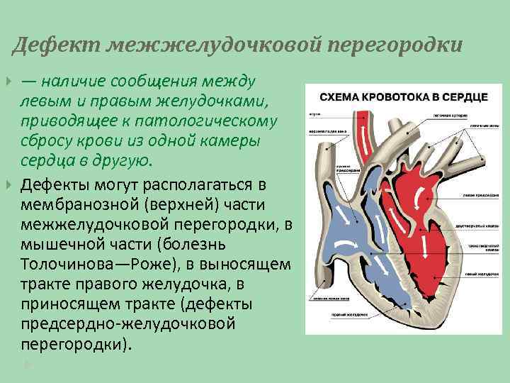 Дефект межжелудочковой перегородки — наличие сообщения между левым и правым желудочками, приводящее к патологическому