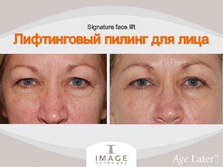 Signature face lift Лифтинговый пилинг для лица 