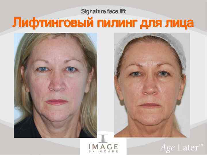 Signature face lift Лифтинговый пилинг для лица 