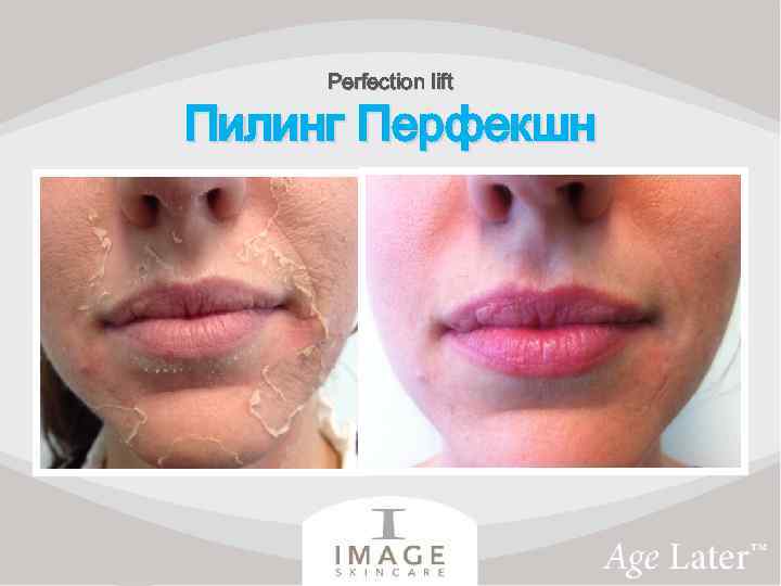 Perfection lift Пилинг Перфекшн 