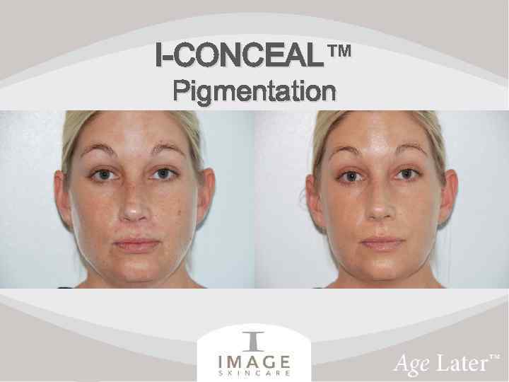 I-CONCEAL™ Pigmentation 