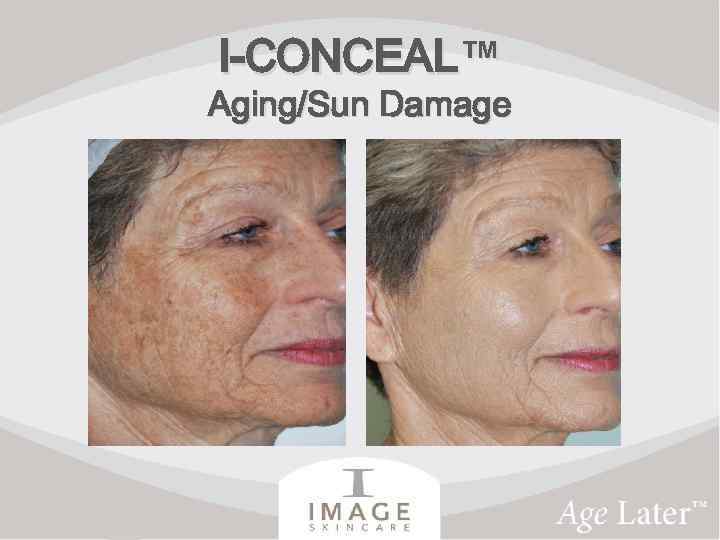 I-CONCEAL™ Aging/Sun Damage 