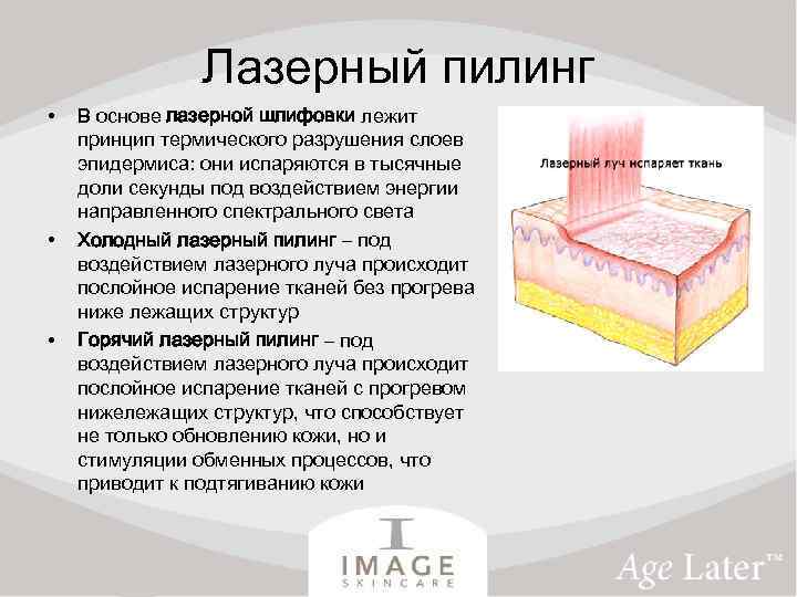 Лазерный пилинг • • • В основе лазерной шлифовки лежит принцип термического разрушения слоев