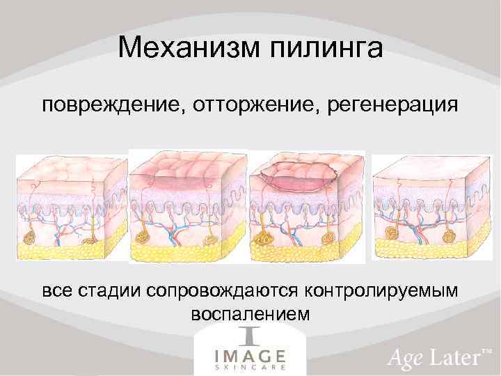 Механизм пилинга повреждение, отторжение, регенерация все стадии сопровождаются контролируемым воспалением 