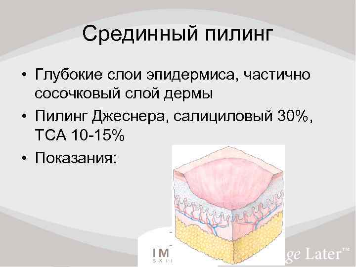 Срединный пилинг • Глубокие слои эпидермиса, частично сосочковый слой дермы • Пилинг Джеснера, салициловый