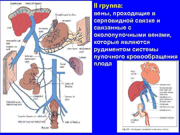 Полиорганная недостаточность патофизиология презентация