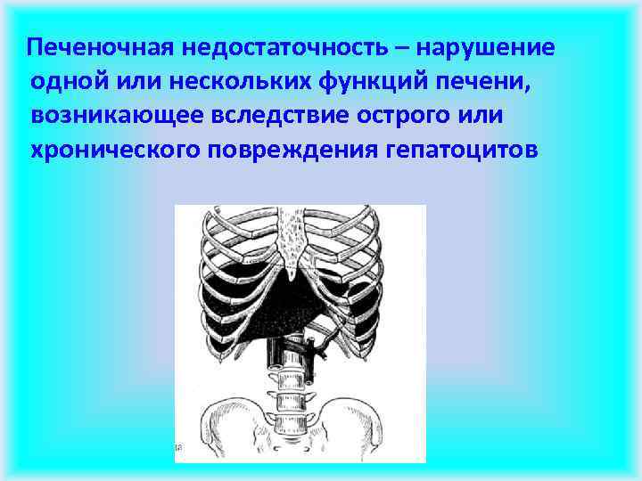 Печеночная недостаточность – нарушение одной или нескольких функций печени, возникающее вследствие острого или хронического