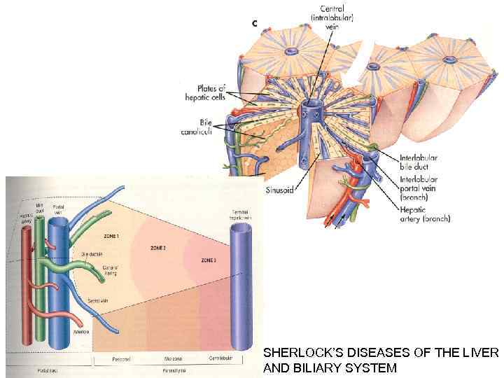 SHERLOCK’S DISEASES OF THE LIVER AND BILIARY SYSTEM 