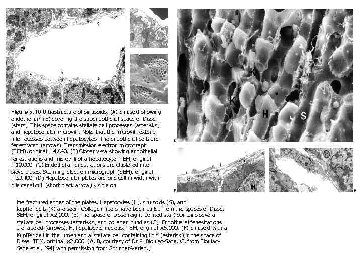 Figure 5. 10 Ultrastructure of sinusoids. (A) Sinusoid showing endothelium (E) covering the subendothelial