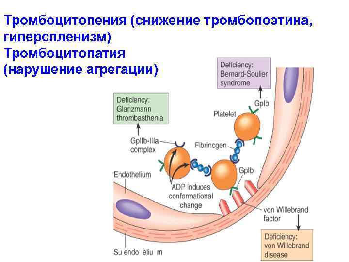 Тромбоцитопатия клинические рекомендации