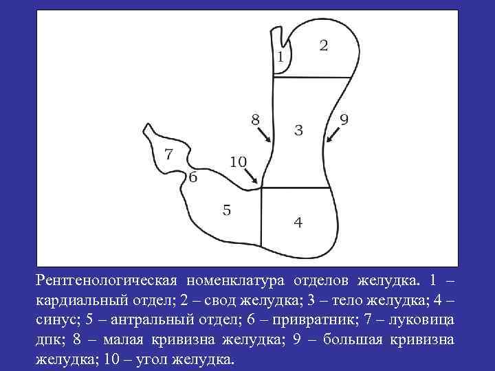 Рентгенологическая номенклатура отделов желудка. 1 – кардиальный отдел; 2 – свод желудка; 3 –