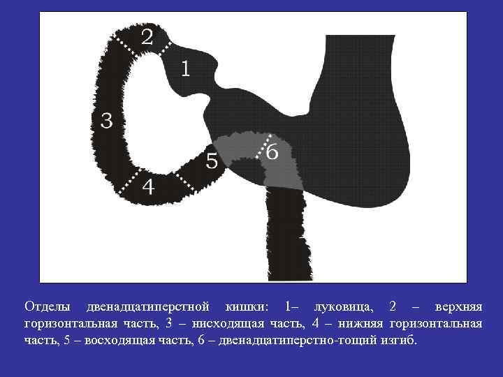 Отделы двенадцатиперстной кишки: 1– луковица, 2 – верхняя горизонтальная часть, 3 – нисходящая часть,