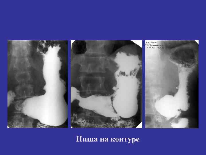 Ниша на контуре 