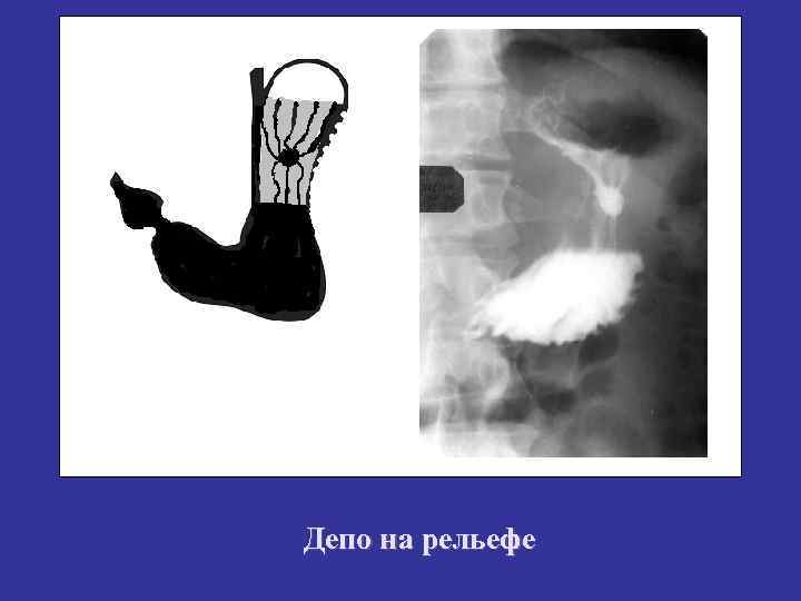 Депо на рельефе 