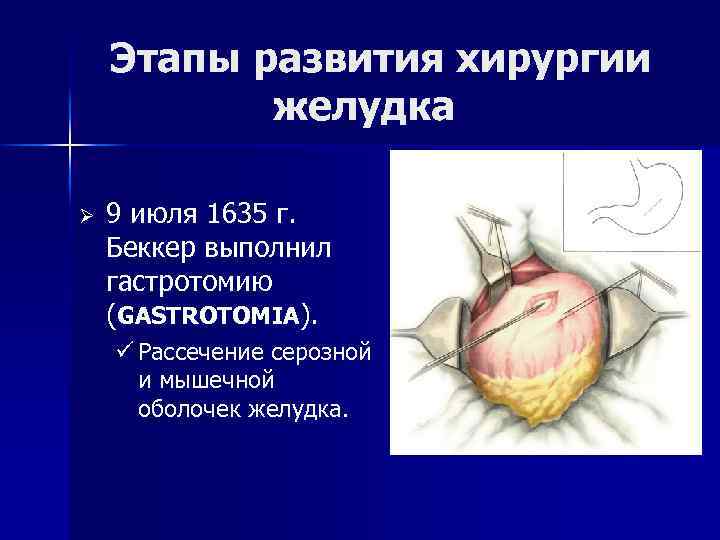 Язвенная болезнь желудка карта вызова