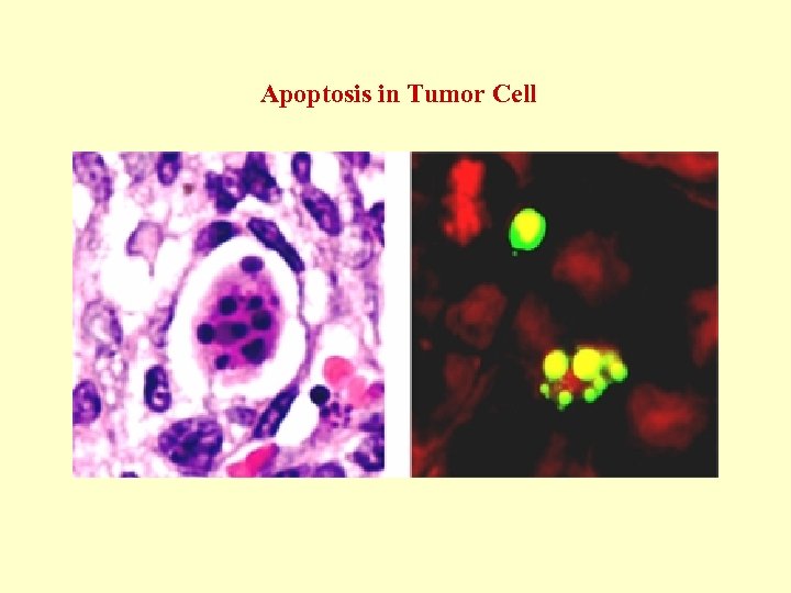 Apoptosis in Tumor Cell 