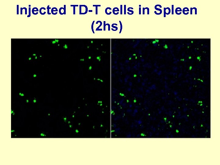 Injected TD-T cells in Spleen (2 hs) 