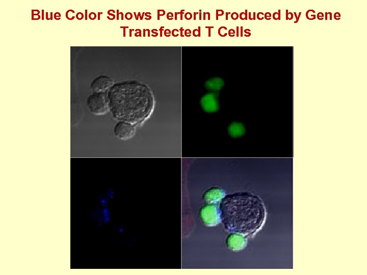 Blue Color Shows Perforin Produced by Gene Transfected T Cells 
