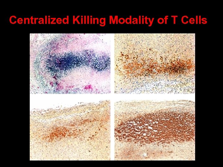 Centralized Killing Modality of T Cells 