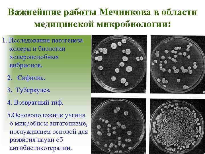 Важнейшие работы Мечникова в области медицинской микробиологии: 1. Исследования патогенеза холеры и биологии холероподобных