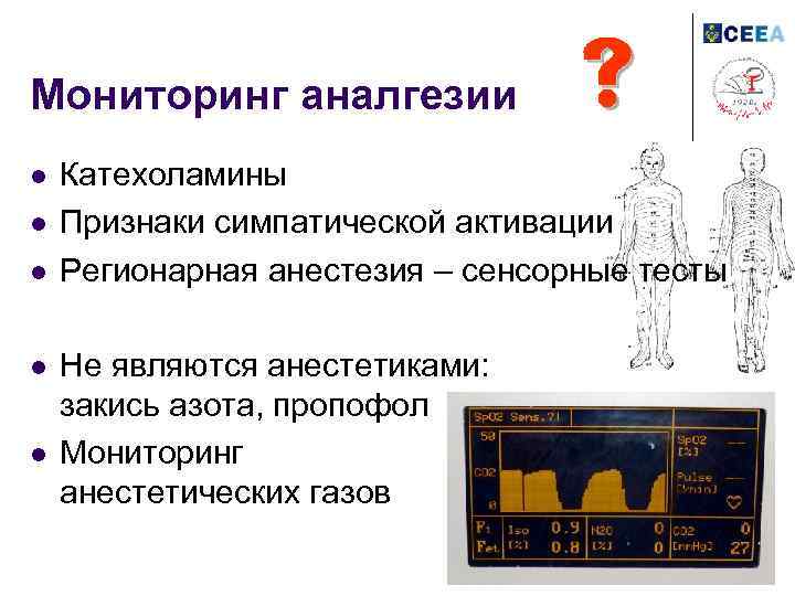 Мониторинг аналгезии l l l Катехоламины Признаки симпатической активации Регионарная анестезия – сенсорные тесты