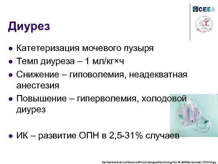 Диурез l l l Катетеризация мочевого пузыря Темп диуреза – 1 мл/кг×ч Снижение –