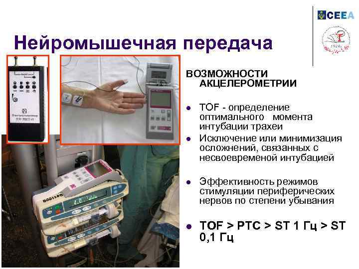 Нейромышечная передача ВОЗМОЖНОСТИ АКЦЕЛЕРОМЕТРИИ l l TOF - определение оптимального момента интубации трахеи Исключение