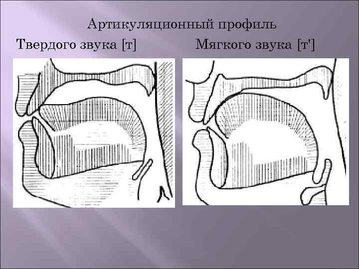 Артикуляционный профиль Твердого звука [т] Мягкого звука [т'] 