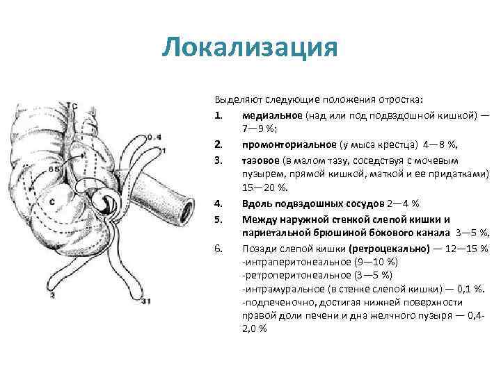 Особенности клинической картины острого аппендицита при тазовом расположении червеобразного отростка