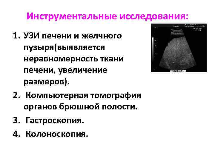 Инструментальные исследования: 1. УЗИ печени и желчного пузыря(выявляется неравномерность ткани печени, увеличение размеров). 2.