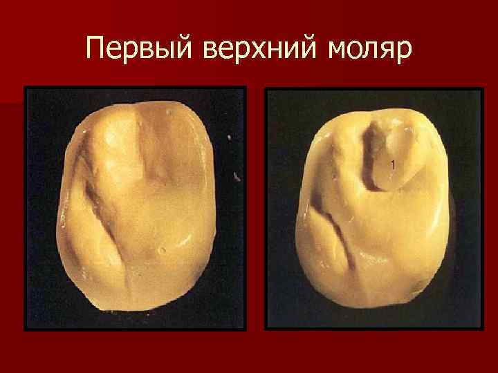 Моляры верхней челюсти фото