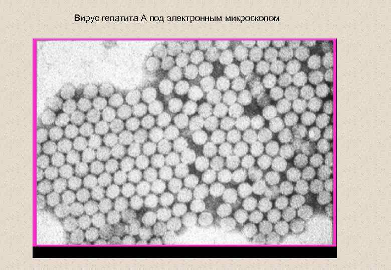 Вирус гепатита А под электронным микроскопом 