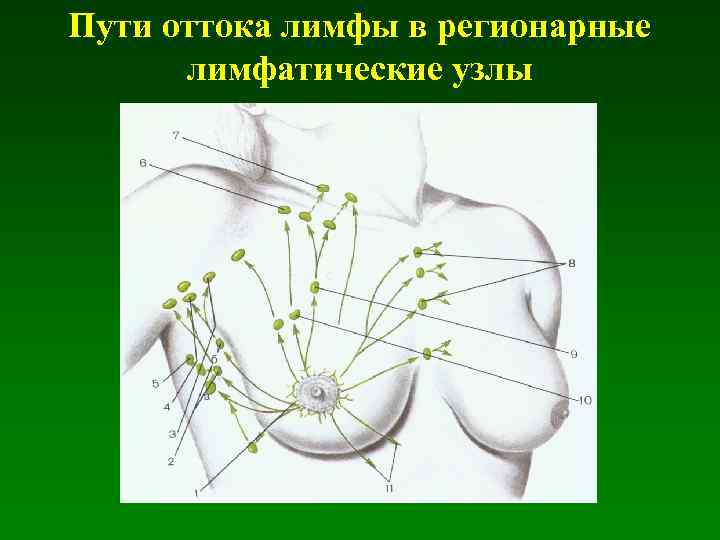 Аксилярные лимфатические узлы молочных желез