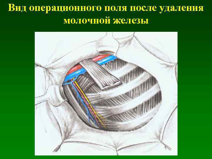 Молочные железы до и после родов фото