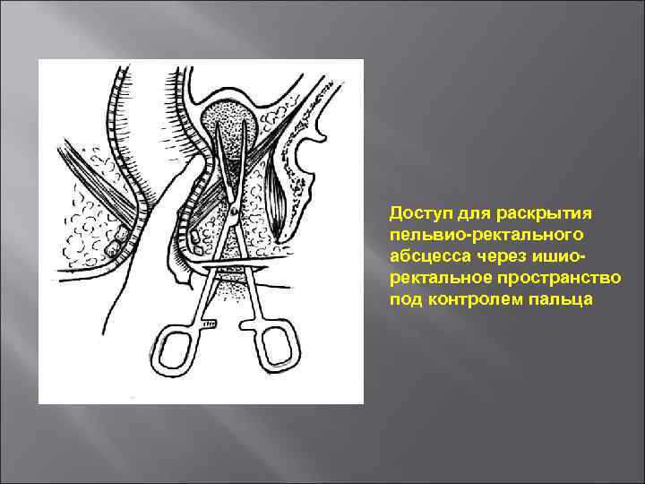 Парапроктит у собак: причины воспаления, …