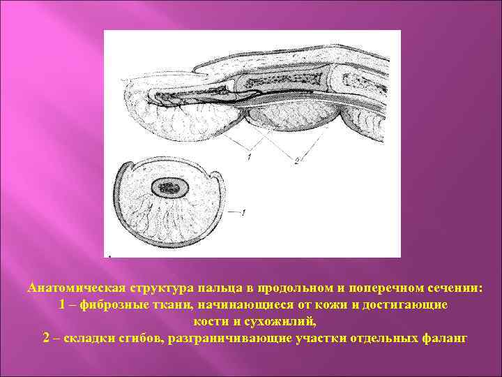 Анатомическая структура пальца в продольном и поперечном сечении: 1 – фиброзные ткани, начинающиеся от