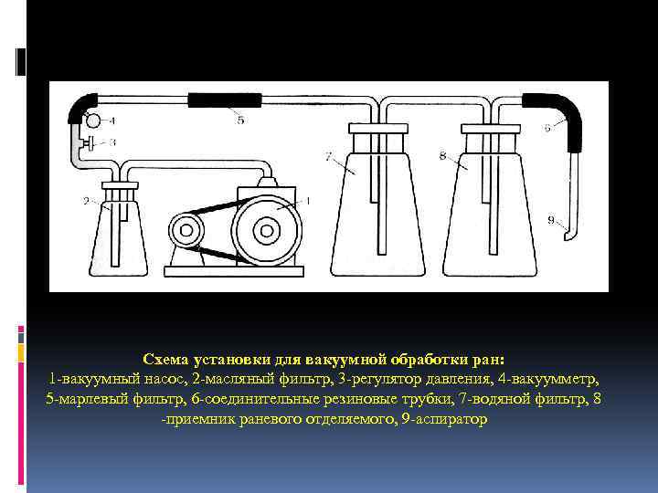 Схема установки для вакуумной обработки ран: 1 -вакуумный насос, 2 -масляный фильтр, 3 -регулятор