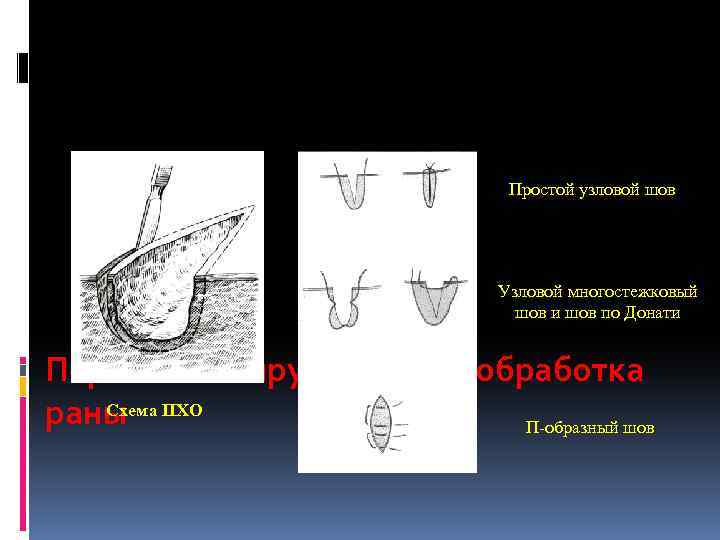 Схема ожерелье узловая