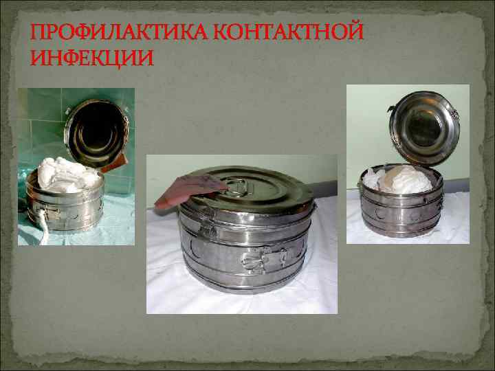 ПРОФИЛАКТИКА КОНТАКТНОЙ ИНФЕКЦИИ 