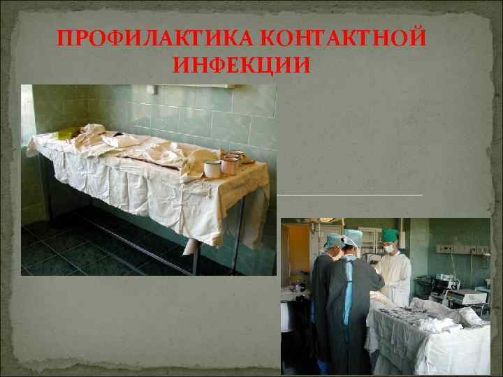 ПРОФИЛАКТИКА КОНТАКТНОЙ ИНФЕКЦИИ 