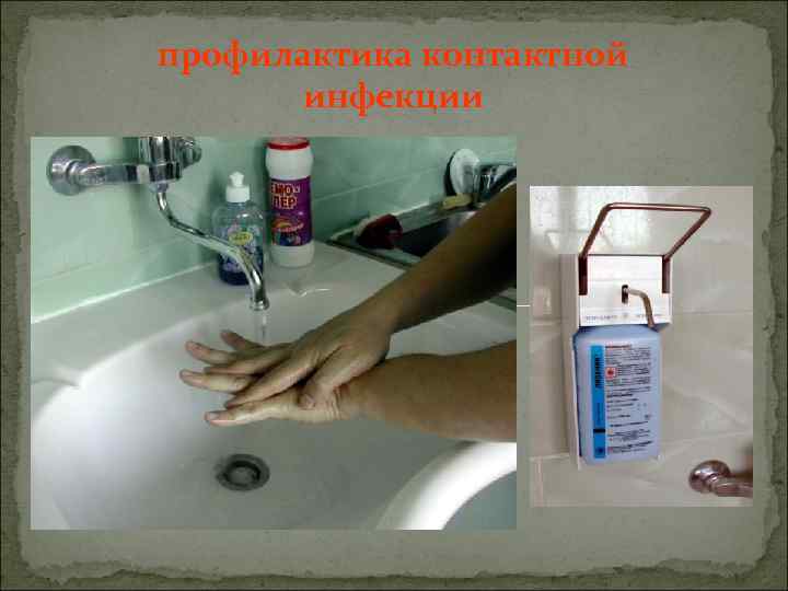 профилактика контактной инфекции 